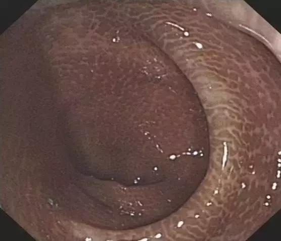 315黑科技大揭秘,315消费者权益日科普小知识广告