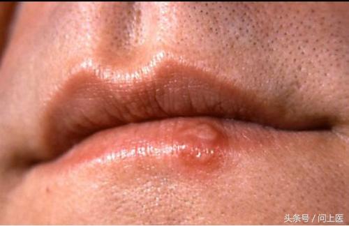 人常见的皮肤病,十二种最常见的皮肤问题对照图