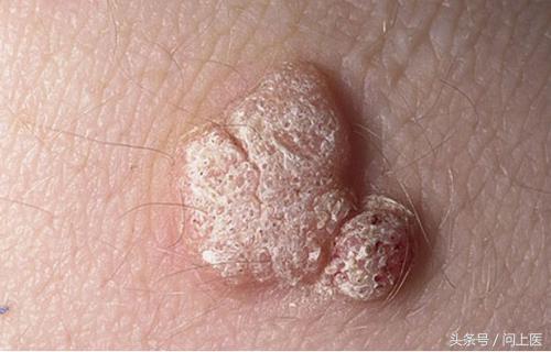 人常见的皮肤病,十二种最常见的皮肤问题对照图