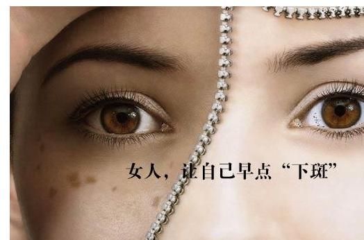 祛斑用药水祛斑好还是激光祛斑好,祛斑方法用什么祛斑效果最好