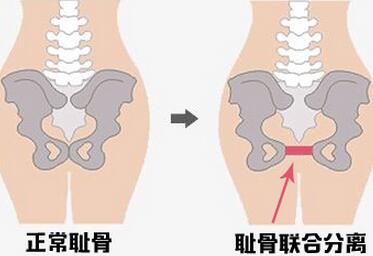 顺产疼为什么还要坚持顺产,都说顺产好