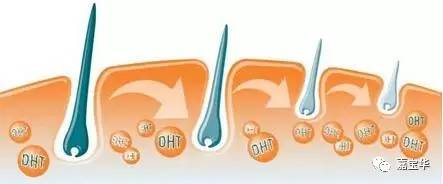 健身脱发是什么原因导致的,两鬓脱发什么原因导致的