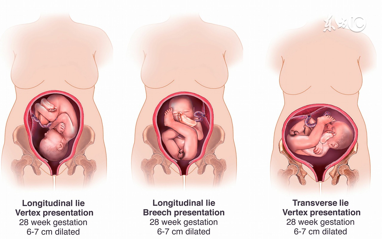 顺产侧切伤口怎么护理伤口好得快,顺产侧切伤口如何护理恢复比较快