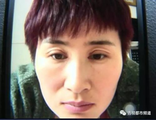 伶秀天成美容院,伶秀天成医疗美容好吗