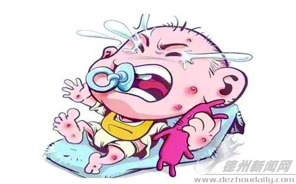 妈妈吃螃蟹引起的婴儿湿疹,宝宝湿疹母乳妈妈能够吃海鲜吗