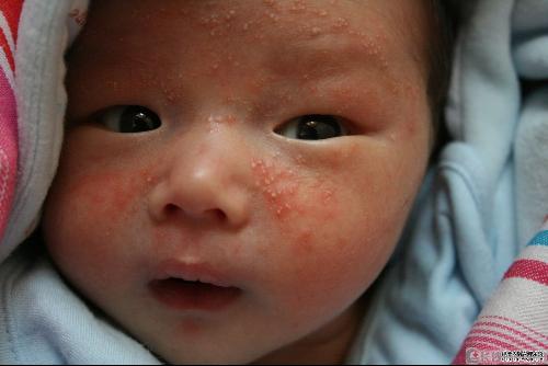 8种食物对孩子健康不好,8种可能引发最严重过敏的食物