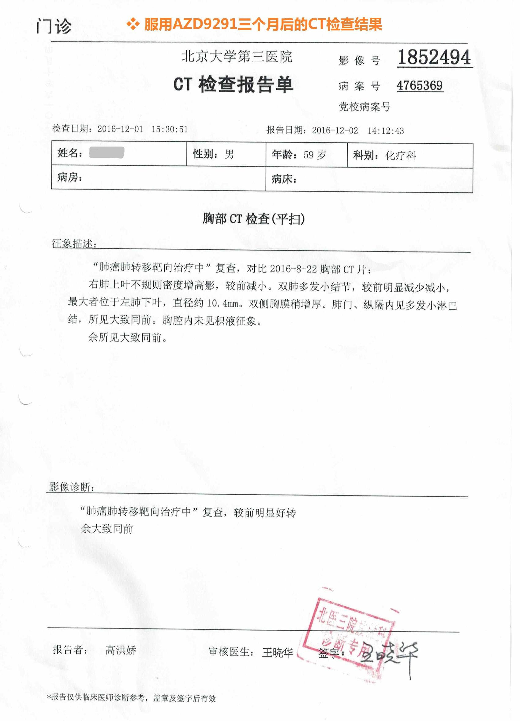 azd9291靶向药价格,azd9291去哪里买