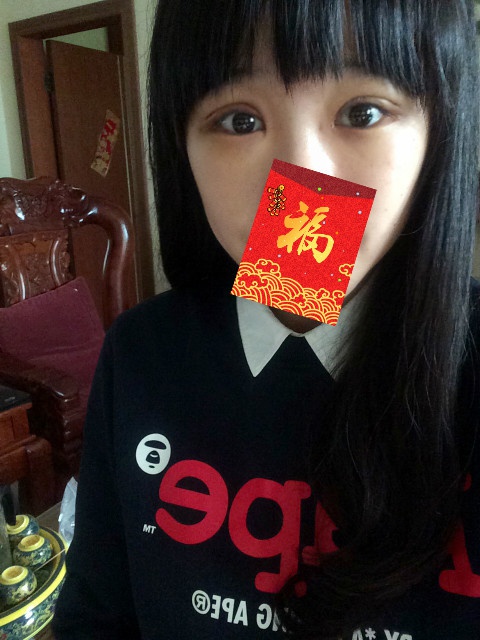 全切双眼皮20天了还一大一小,全切双眼皮的第二个月不来大姨妈