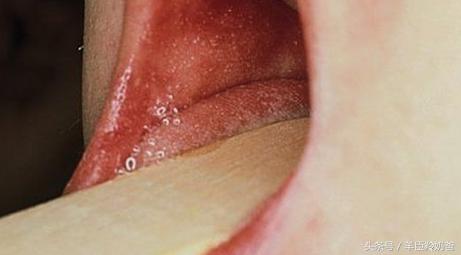 宝宝出麻疹的三大症状和治疗方法,小孩种麻疹疫苗后出现麻疹症状