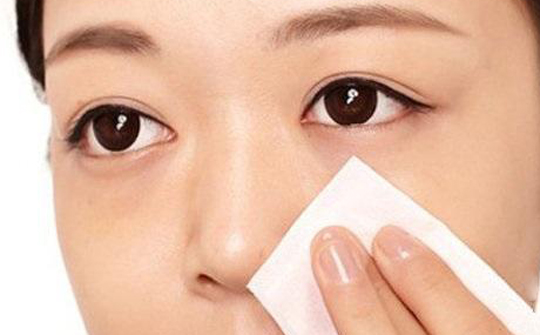 鼻子旁边有黑头和痘痘怎么去掉,学生鼻子上的黑头怎么去掉小妙招