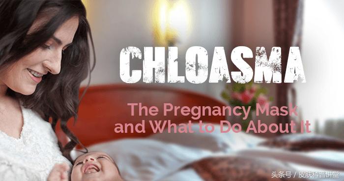 褐斑的原因和治疗方法,褐斑的最佳治疗方法