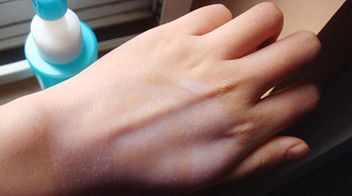 拒绝草莓鼻让你和黑头说再见,草莓鼻搞定黑头其实也没那么难