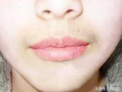 青春期唇毛很难看,孩子唇毛多难看怎么办