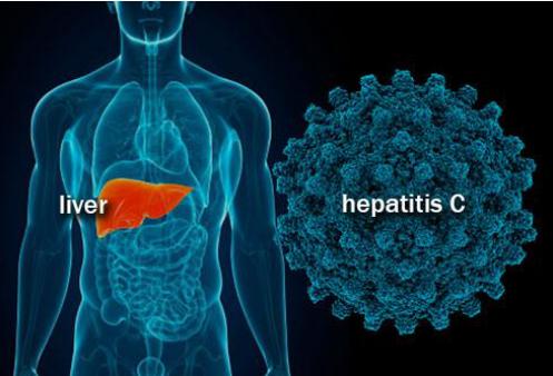 丙肝能够治愈吗还需要吃药按摩,丙肝能够治愈吗