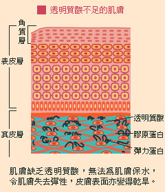 玻尿酸有什么功能,你知道玻尿酸多少一公斤吗