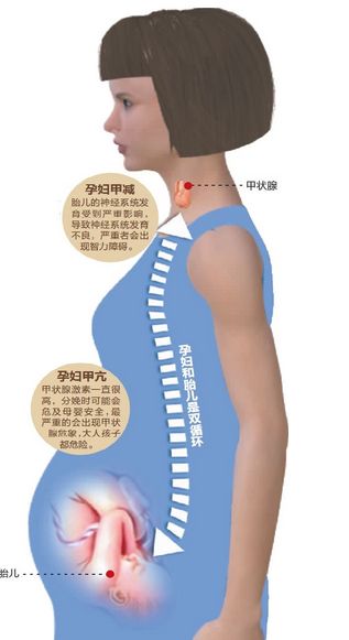 孕妇桥本甲状腺炎对胎儿有影响吗,孕妇甲状腺高胎儿畸形的几率高吗