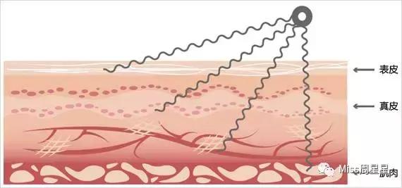 行家来告诉你美容仪真的管用吗,美容仪真的有用吗运用了哪些原理