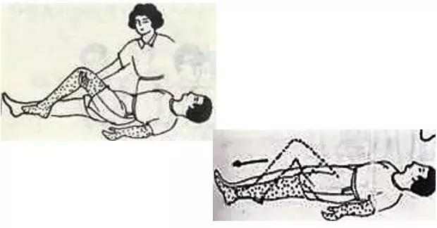 脑梗死锻炼能够恢复双腿无力么,脑梗死运动障碍