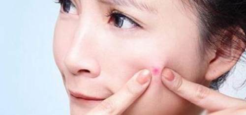 如何让脸变得没有痘变得更白净,脸上全是大大小小的红痘印