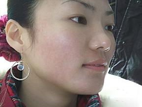 战痘的小秘诀,战痘的血泪史完全版