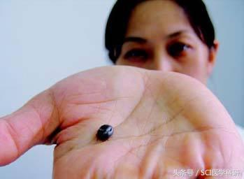 人见人怕的蜱虫含有特殊蛋白，是治疗人类超级细菌药物的唯一原料