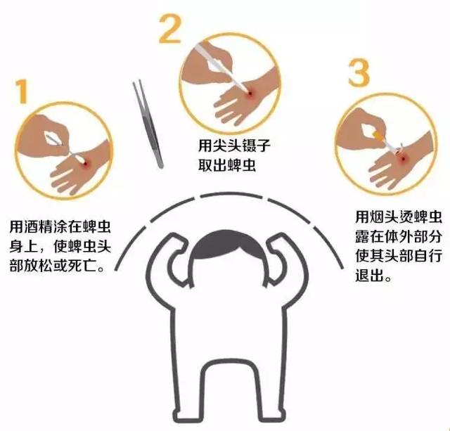 蚊子皮肤细菌感染溃烂,蚊虫叮咬能够拍吗