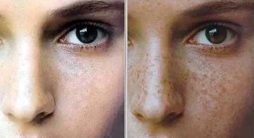 那些被日照选为“斑”长的肌肤，得学会这样自救