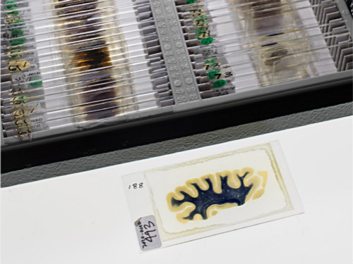 你有斟酌过将来捐献器官救人吗,陈天桥为什么执着脑科学研究