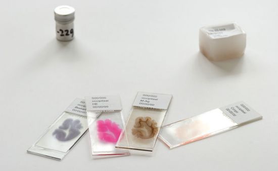 你有斟酌过将来捐献器官救人吗,陈天桥为什么执着脑科学研究