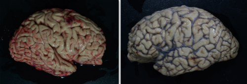 你有斟酌过将来捐献器官救人吗,陈天桥为什么执着脑科学研究