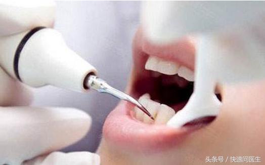 拔牙禁忌拔牙前后你需要注意什么,拔牙后疼痛会持续多久能够吃什么