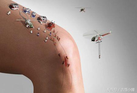 细疤痕怎么去掉最好方法,去除多年疤痕教你一个小妙招