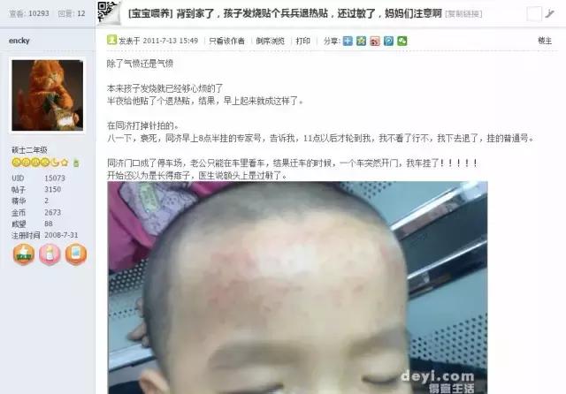 退热贴过敏会全身起红疹吗,退热贴过敏后额头爆皮