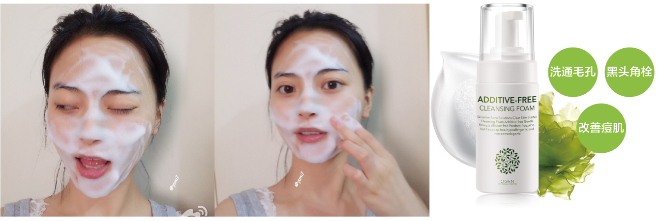 下巴有肉刺是什么病,下巴下面长很多小白点像白粉刺