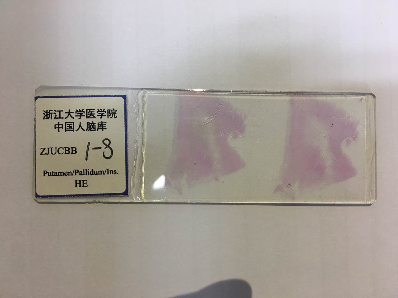 你有斟酌过将来捐献器官救人吗,陈天桥为什么执着脑科学研究