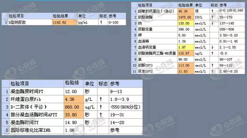 急性心肌梗死心源性休克时的处理,急性心肌梗死心源性休克最常见