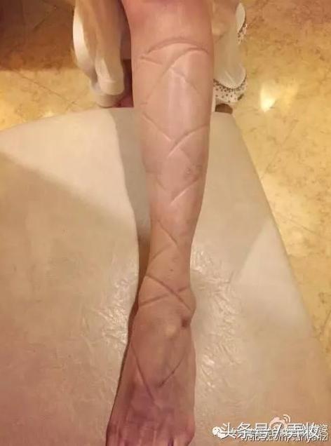 杨幂的脚很臭，而这些女明星的脚“惨不忍睹”