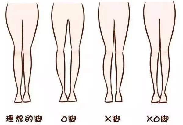 腿型不好看穿短裙怎么办,腿型不好看怎么练