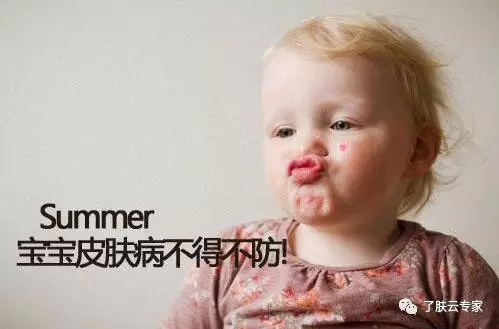 儿童皮肤病防治知识大全,儿童皮肤科护理流程