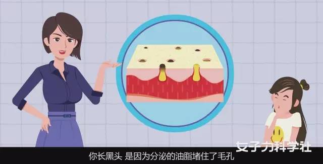 异维a酸红霉素凝胶去黑头缩毛孔,长沙医美去黑头缩毛孔大概多少钱