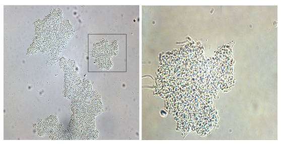 酵母菌对活性污泥的影响,活性污泥怎么没有菌胶团