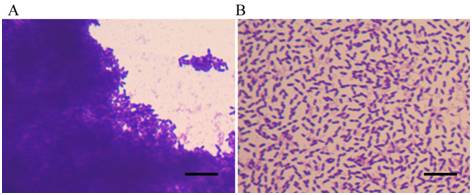 酵母菌对活性污泥的影响,活性污泥怎么没有菌胶团