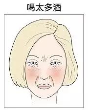 肤色不均痘印暗沉黑眼圈,长痘有法令纹真的会让人自卑