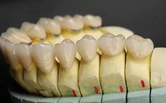 牙医怎么选最好,如何选择合适的烤瓷牙