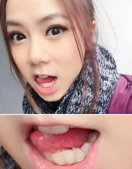 整牙变美第一步,整牙变脸