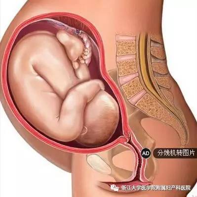 「科普时间」孕产妇忽视了它，可能会有*麻大**烦！