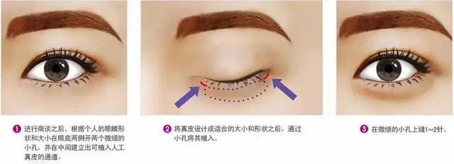 卧蚕眼袋黑眼圈傻傻分不清楚,卧蚕和眼袋的区别图片对比