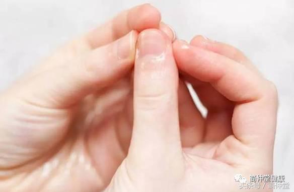 夏天手起皮用什么药膏,夏天干燥起皮怎么补水