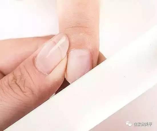 玛蒂被折断手指,玛蒂折断手指