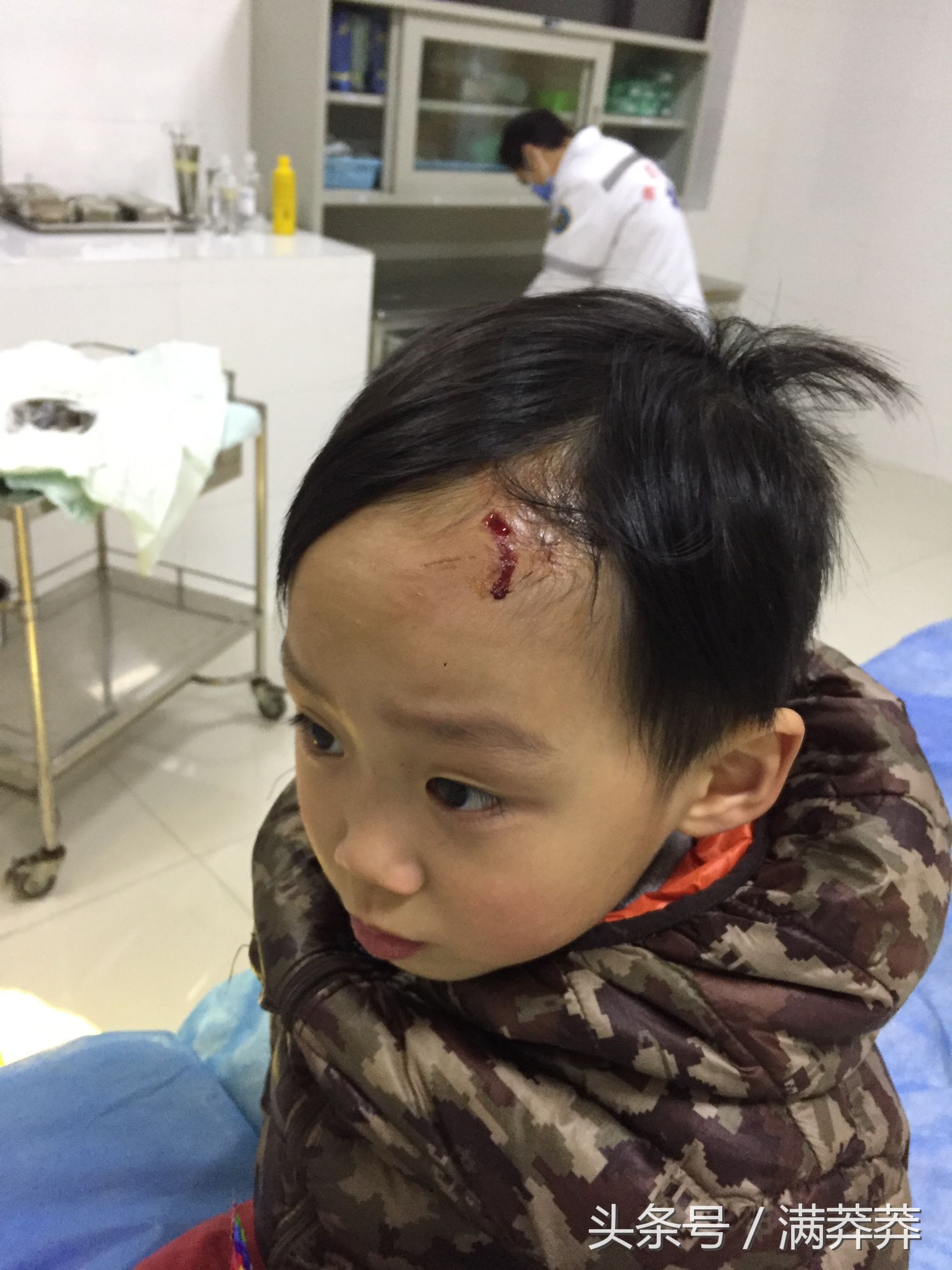 小孩额头摔破需要打破伤风针，可是破伤风抗毒素针测试过敏，为什么破伤风人体免疫球蛋白一针难求？